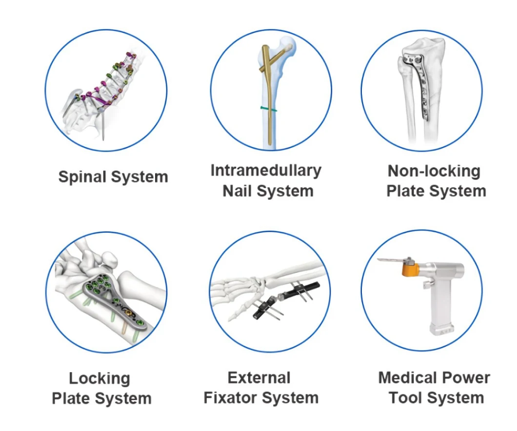 Medical Orthopedic Implant Suture Wires Titanium Orthopedic Surgical Cerclage Wire